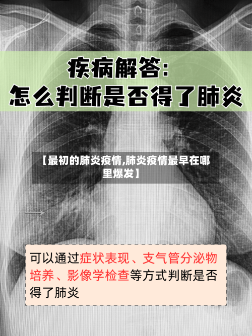 【最初的肺炎疫情,肺炎疫情最早在哪里爆发】