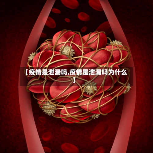 【疫情是泄漏吗,疫情是泄漏吗为什么】-第2张图片